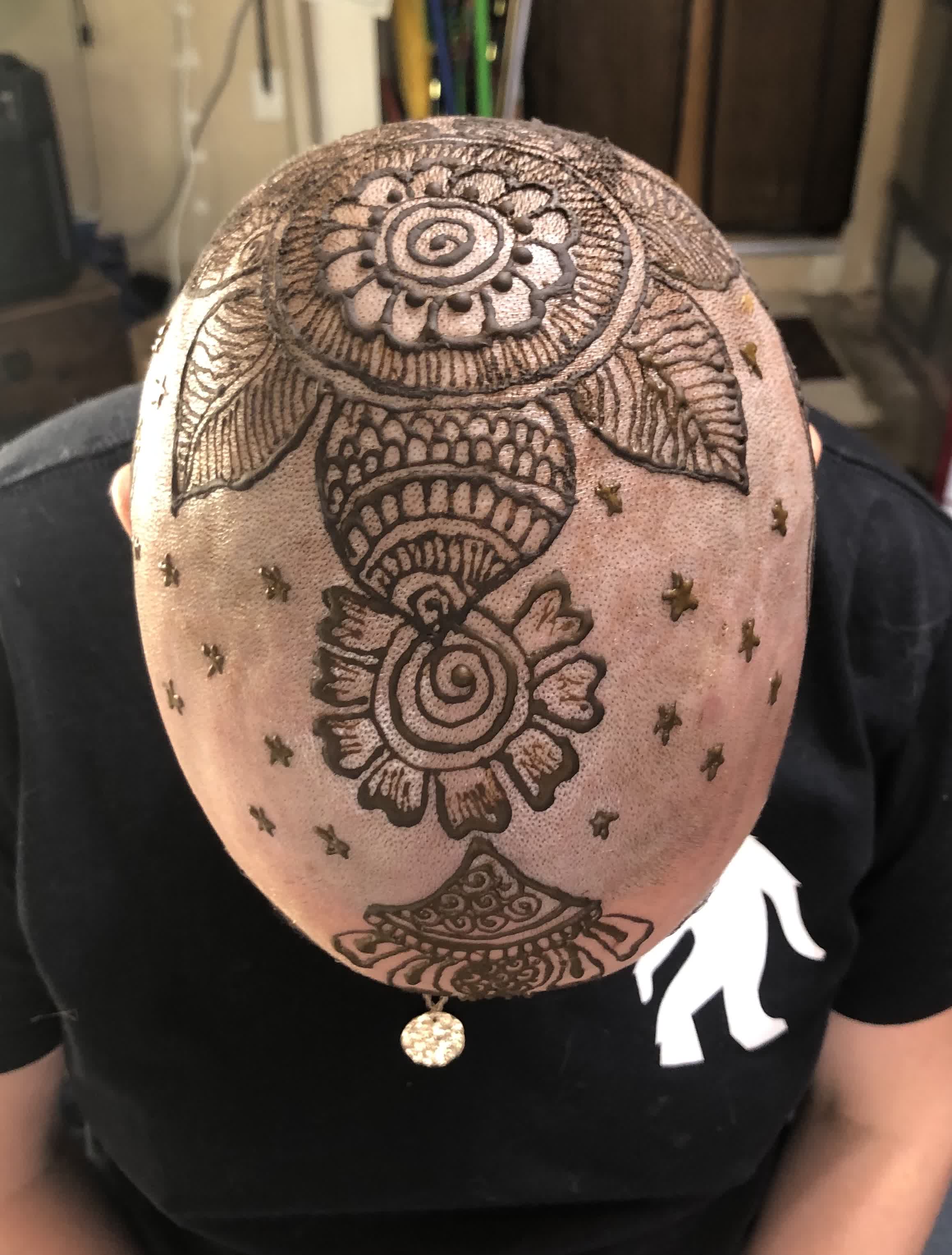 Delicate henna crown design with mandala and floral motifs applied to a cancer patient's scalp